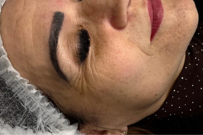 Stan skóry przed terapią kosmetologiczną w SkinCareWithMargo